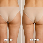 Lipocavitação Ultrassônica Para Redução De Gordura E Celulite